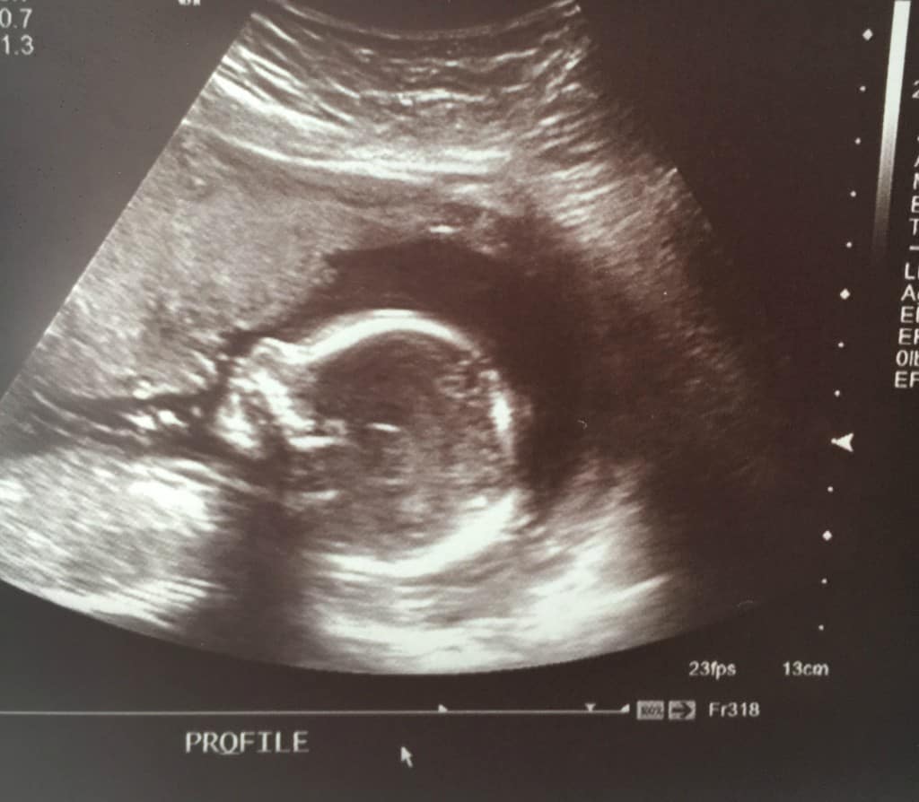 an ultrasound picture of a baby\'s face